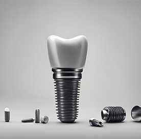Your dental implant has many working parts