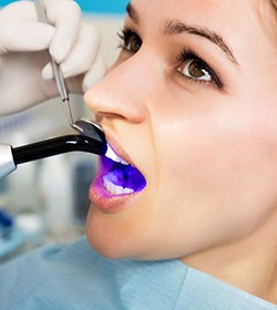 young woman getting tooth-colored filling hardened with curing light 