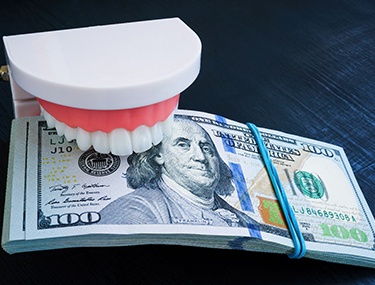 Mouth mold and stack of money